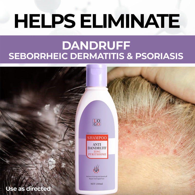 โรงงานผลิตแชมพูขจัดรังแคซิงค์ไพริธิโอไน OEM